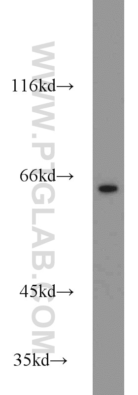 Western Blot (WB) analysis of Jurkat cells using PGM1 Polyclonal antibody (15161-1-AP)