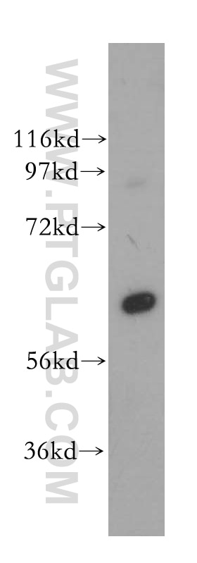 Western Blot (WB) analysis of HeLa cells using PGM1 Polyclonal antibody (15161-1-AP)
