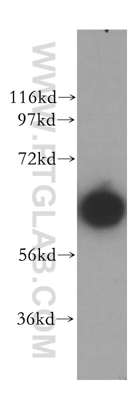 Western Blot (WB) analysis of mouse heart tissue using PGM1 Polyclonal antibody (15161-1-AP)