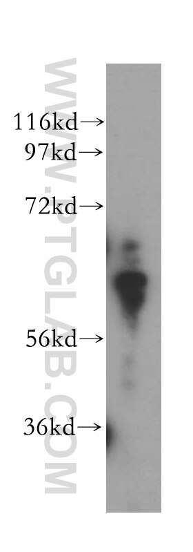 Western Blot (WB) analysis of Jurkat cells using PGM1 Polyclonal antibody (15161-1-AP)