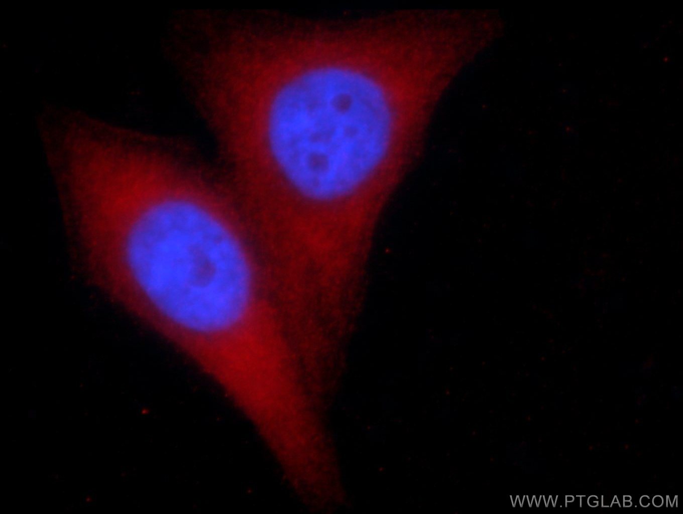 Immunofluorescence (IF) / fluorescent staining of HepG2 cells using PGM1 Monoclonal antibody (66105-1-Ig)