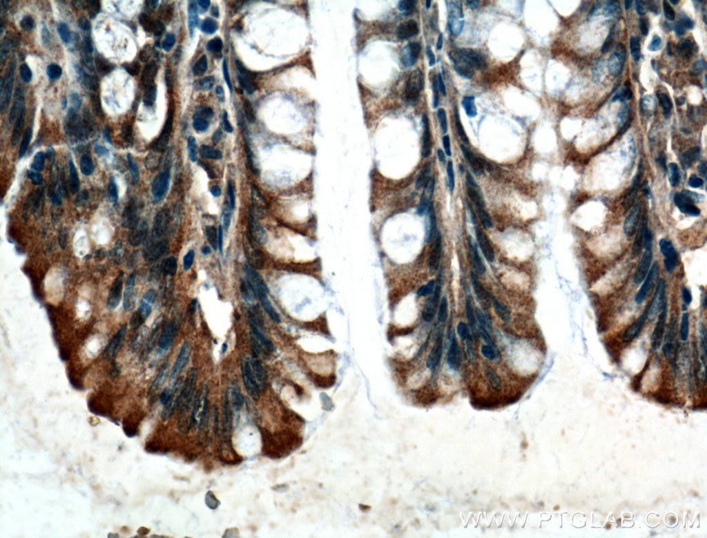 Immunohistochemistry (IHC) staining of human colon tissue using PGM1 Monoclonal antibody (66105-1-Ig)