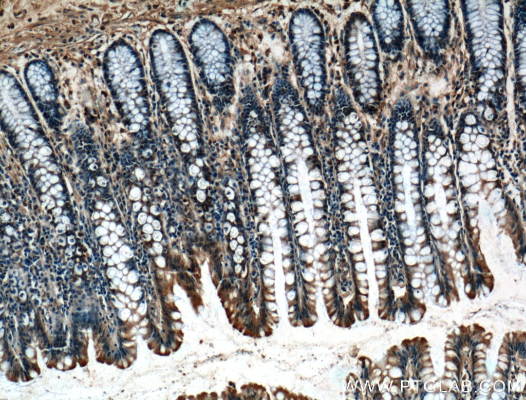 IHC staining of human colon using 66105-1-Ig