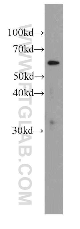 Western Blot (WB) analysis of HepG2 cells using PGM1 Monoclonal antibody (66105-1-Ig)
