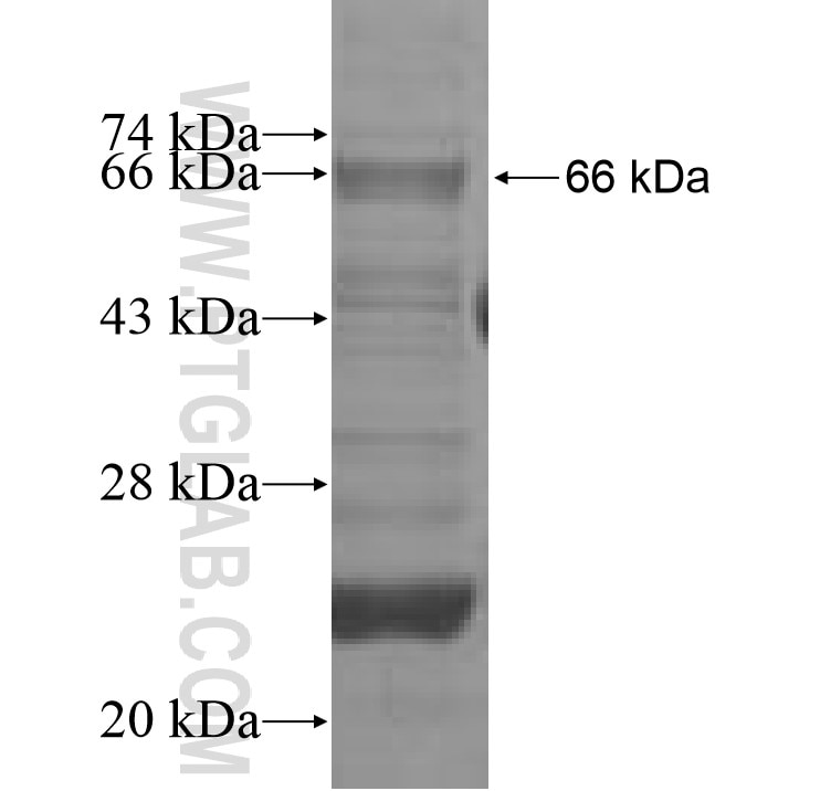 PGM1 fusion protein Ag7269 SDS-PAGE