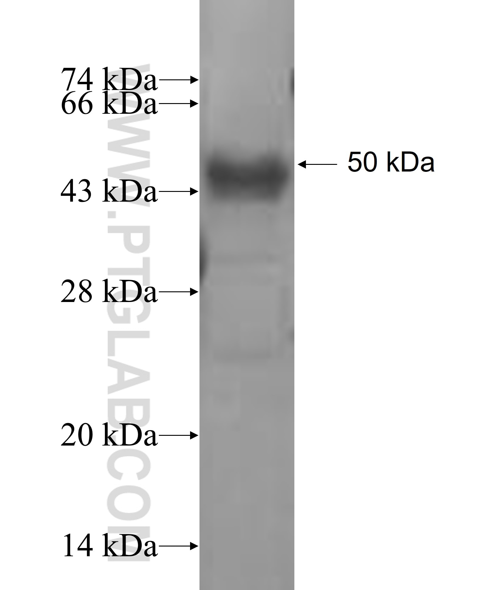 PGM1 fusion protein Ag7294 SDS-PAGE