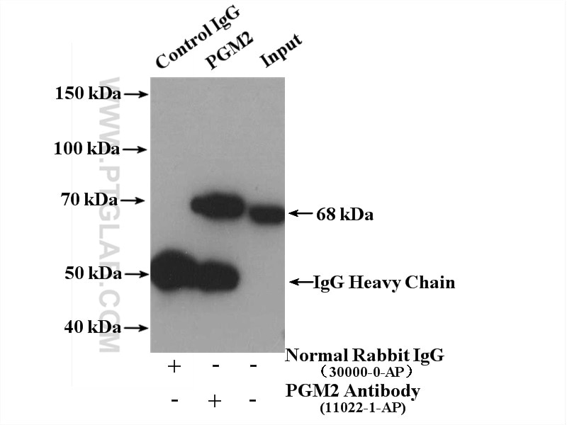 Immunoprecipitation (IP) experiment of HEK-293 cells using PGM2 Polyclonal antibody (11022-1-AP)
