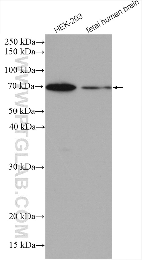 Western Blot (WB) analysis of various lysates using PGM2 Polyclonal antibody (11022-1-AP)