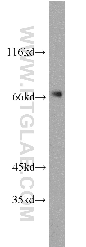 Western Blot (WB) analysis of human brain tissue using PGM2 Polyclonal antibody (11022-1-AP)
