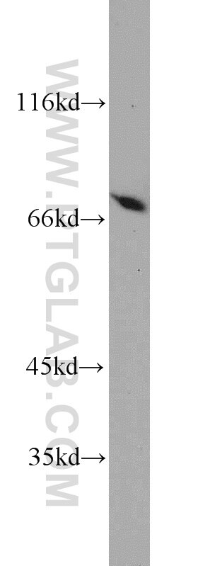 Western Blot (WB) analysis of HEK-293 cells using PGM2 Polyclonal antibody (11022-1-AP)