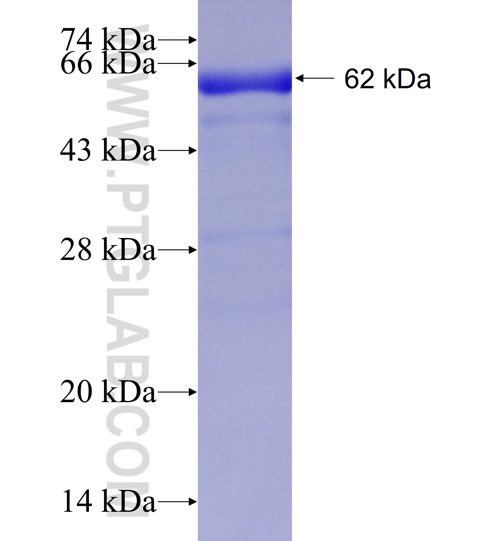 PGM2 fusion protein Ag1488 SDS-PAGE