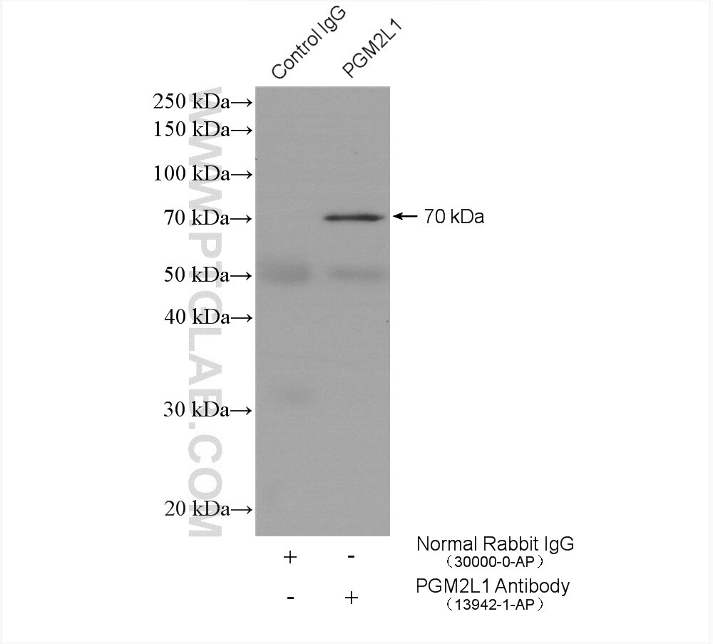 Immunoprecipitation (IP) experiment of mouse brain tissue using PGM2L1 Polyclonal antibody (13942-1-AP)