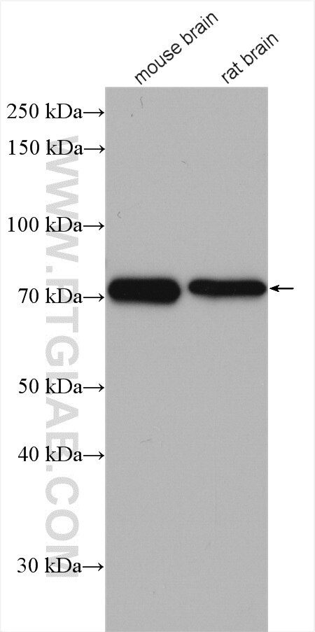 Western Blot (WB) analysis of various lysates using PGM2L1 Polyclonal antibody (13942-1-AP)