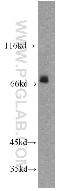 Western Blot (WB) analysis of mouse skeletal muscle tissue using PGM2L1 Polyclonal antibody (13942-1-AP)