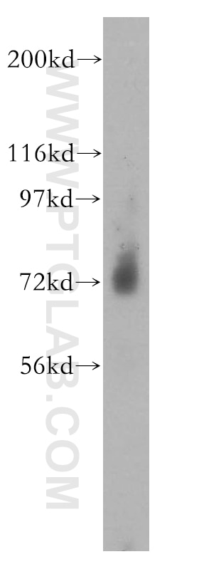 Western Blot (WB) analysis of mouse skeletal muscle tissue using PGM2L1 Polyclonal antibody (13942-1-AP)