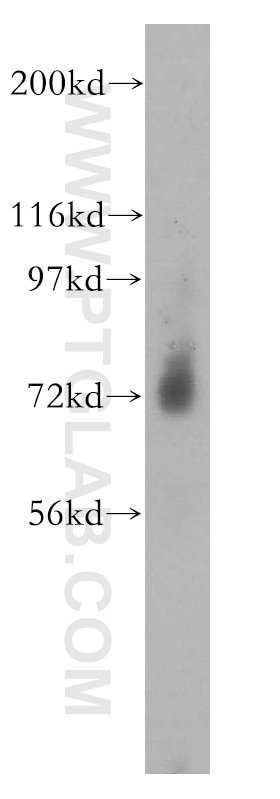 WB analysis of mouse skeletal muscle using 13942-1-AP