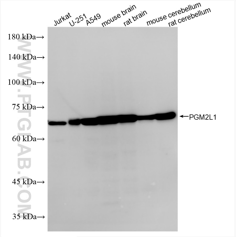 PGM2L1