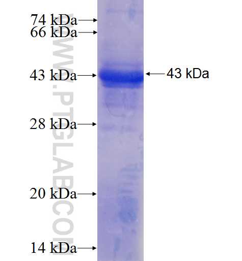 PGM2L1 fusion protein Ag5284 SDS-PAGE