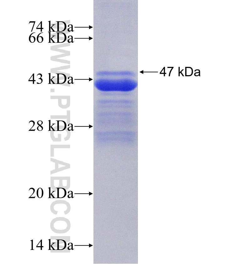 PGM3 fusion protein Ag30504 SDS-PAGE