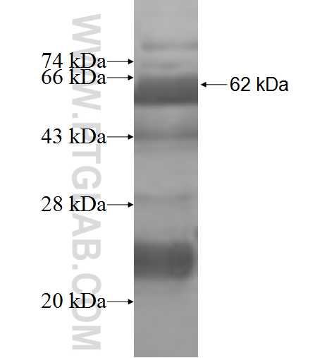 PGM3 fusion protein Ag9979 SDS-PAGE