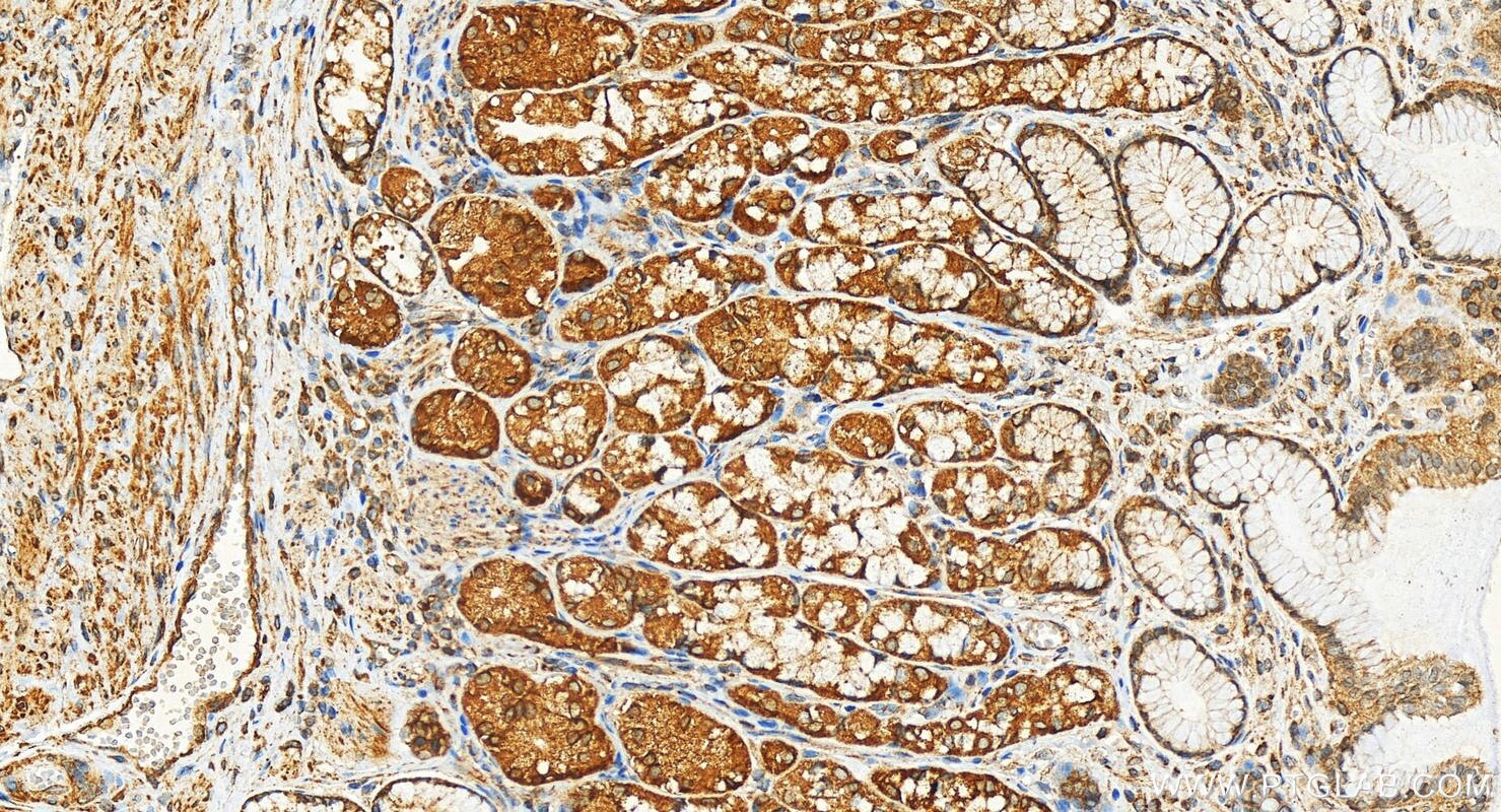 Immunohistochemistry (IHC) staining of human stomach tissue using PGM5 Recombinant antibody (82965-1-RR)