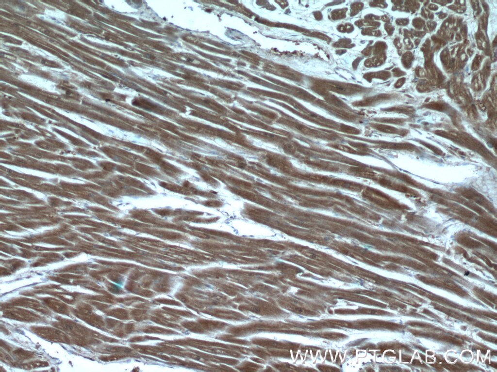 IHC staining of human heart using 25081-1-AP