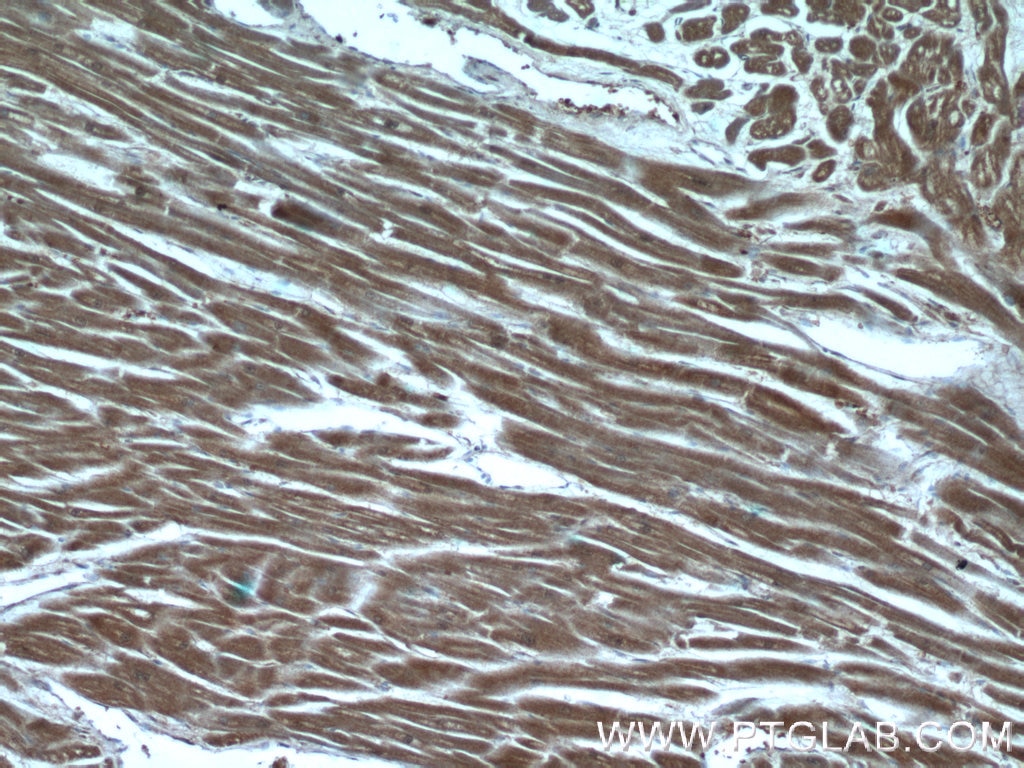 Immunohistochemistry (IHC) staining of human heart tissue using PGP Polyclonal antibody (25081-1-AP)