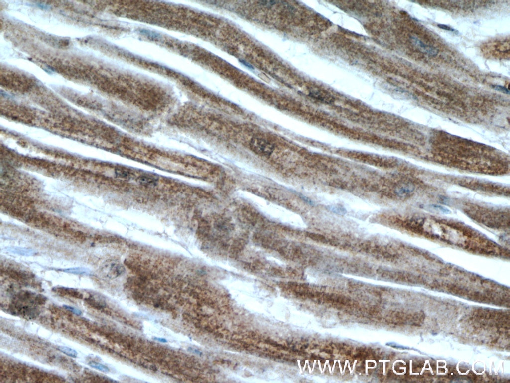 Immunohistochemistry (IHC) staining of human heart tissue using PGP Polyclonal antibody (25081-1-AP)