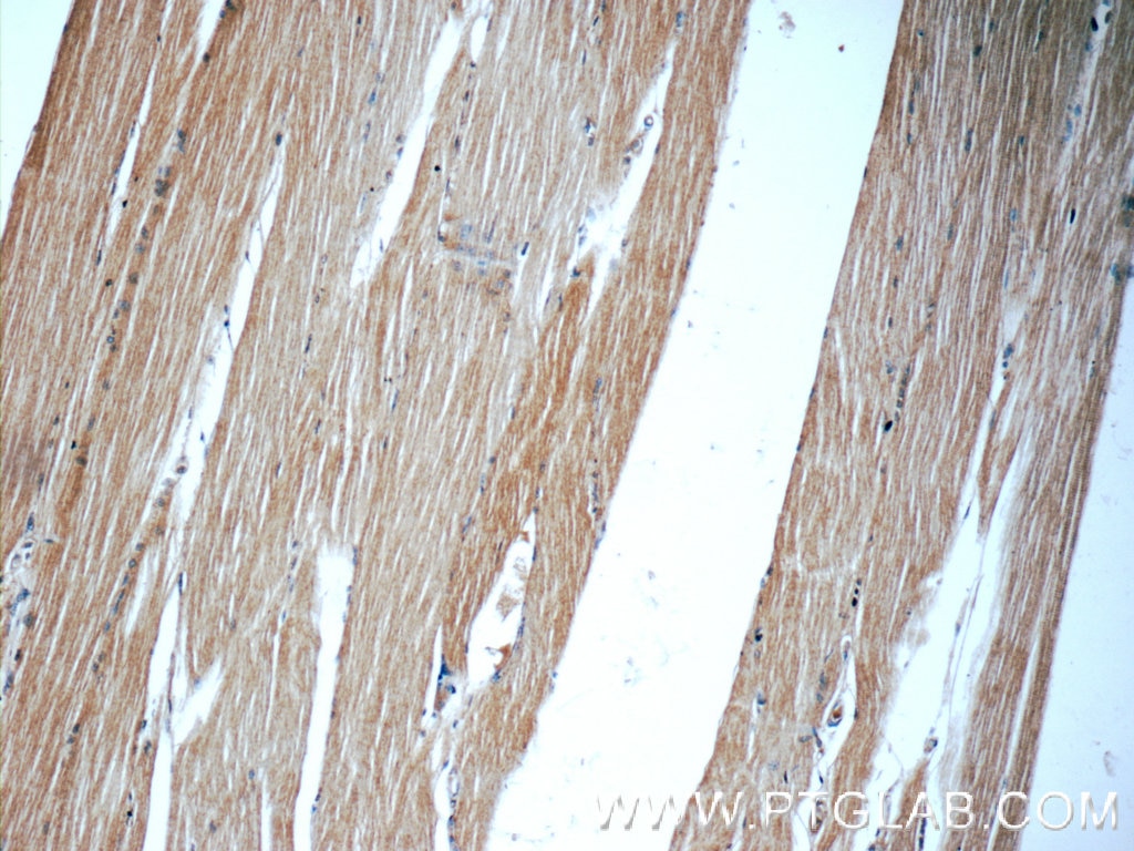 Immunohistochemistry (IHC) staining of human skeletal muscle tissue using PGP Polyclonal antibody (25081-1-AP)