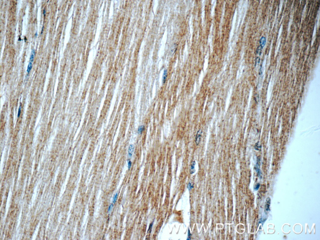 Immunohistochemistry (IHC) staining of human skeletal muscle tissue using PGP Polyclonal antibody (25081-1-AP)