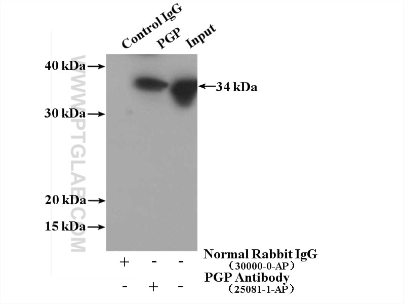 Immunoprecipitation (IP) experiment of Y79 cells using PGP Polyclonal antibody (25081-1-AP)