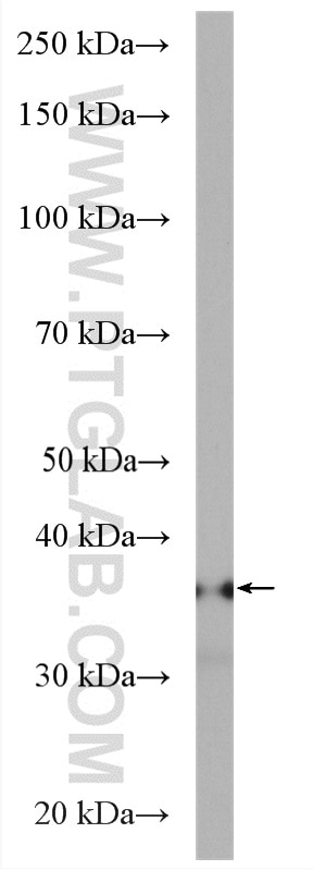 WB analysis of mouse heart using 25081-1-AP