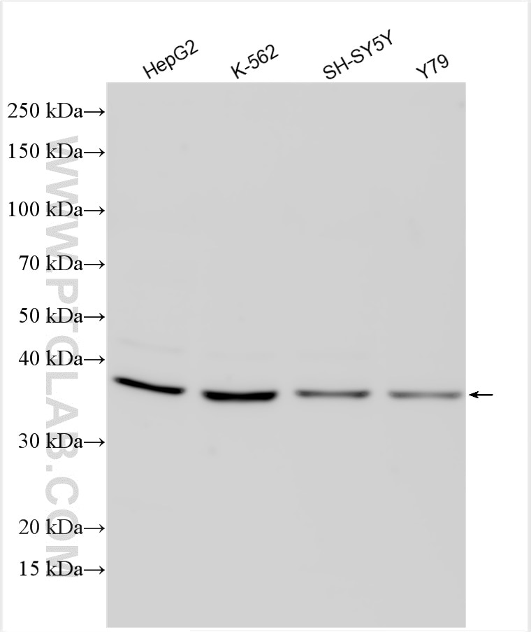 Western Blot (WB) analysis of various lysates using PGP Polyclonal antibody (25081-1-AP)
