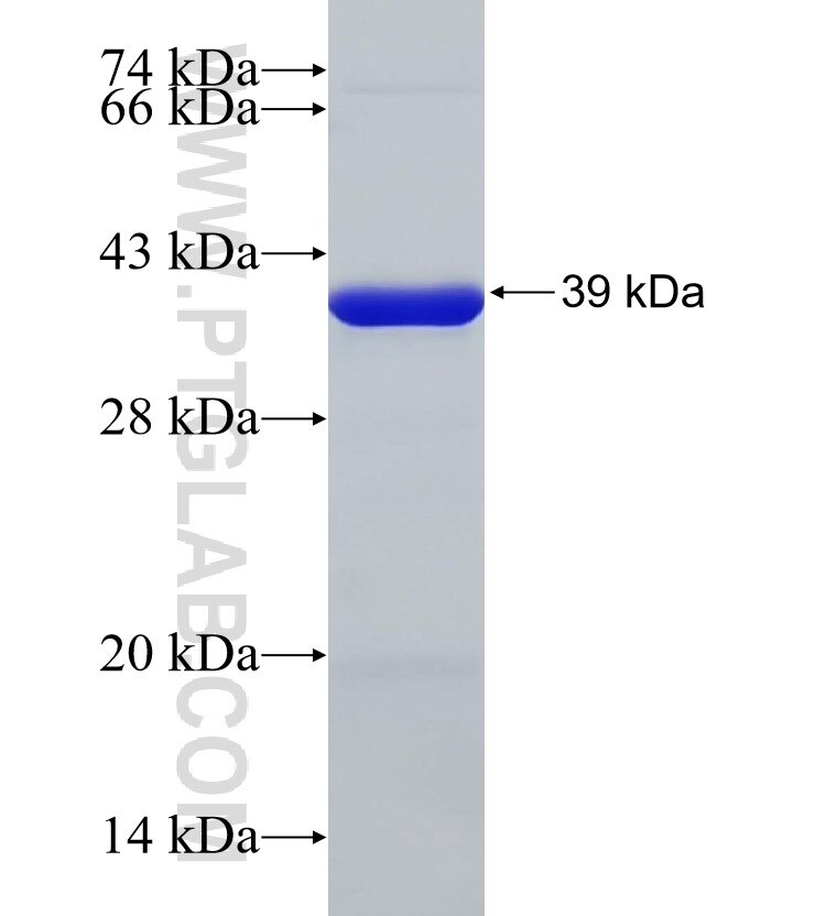 PGP fusion protein Ag33116 SDS-PAGE