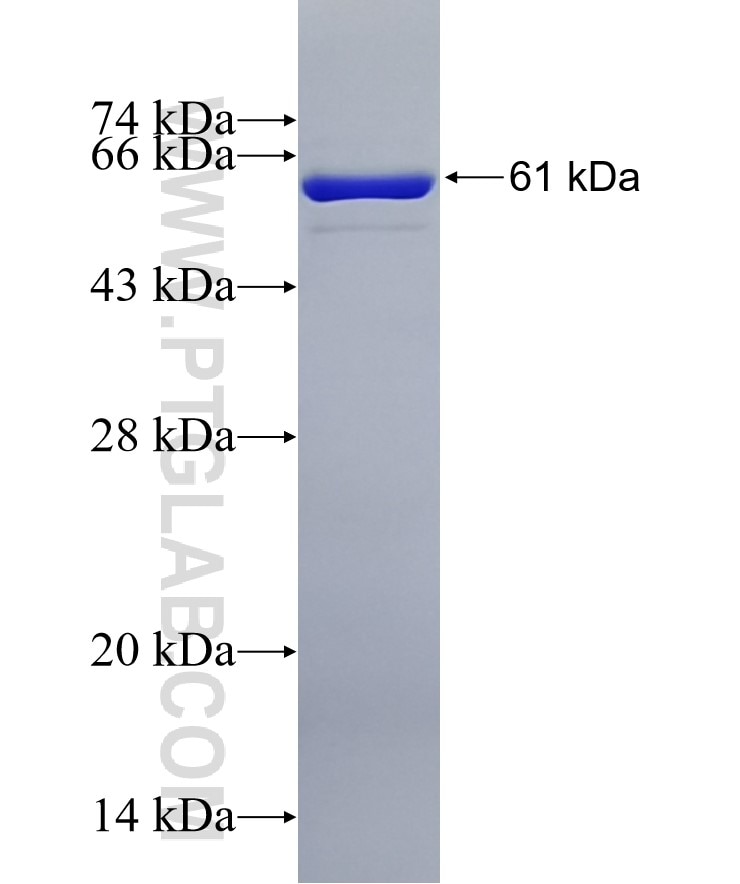 PGP fusion protein Ag18623 SDS-PAGE