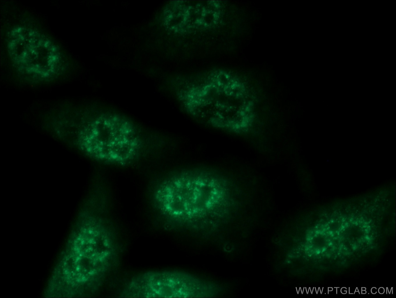 Immunofluorescence (IF) / fluorescent staining of MCF-7 cells using PR Polyclonal antibody (19980-1-AP)