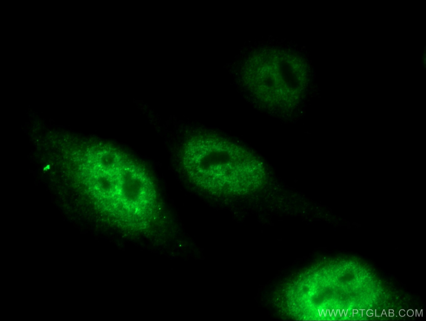 Immunofluorescence (IF) / fluorescent staining of MCF-7 cells using PR Polyclonal antibody (19980-1-AP)