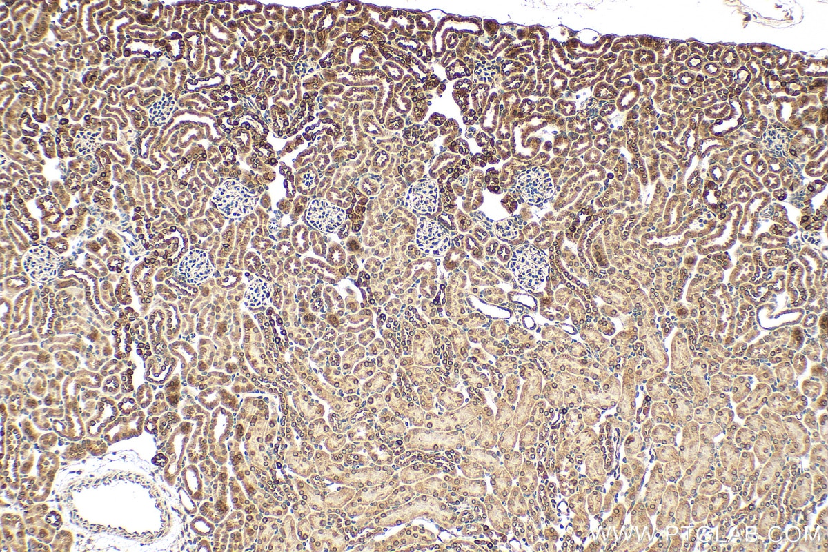 Immunohistochemistry (IHC) staining of mouse kidney tissue using PGRMC1 Polyclonal antibody (12990-1-AP)