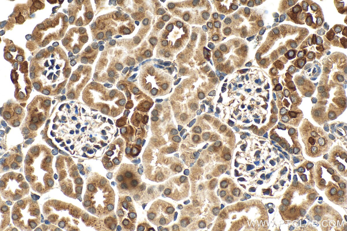Immunohistochemistry (IHC) staining of mouse kidney tissue using PGRMC1 Polyclonal antibody (12990-1-AP)