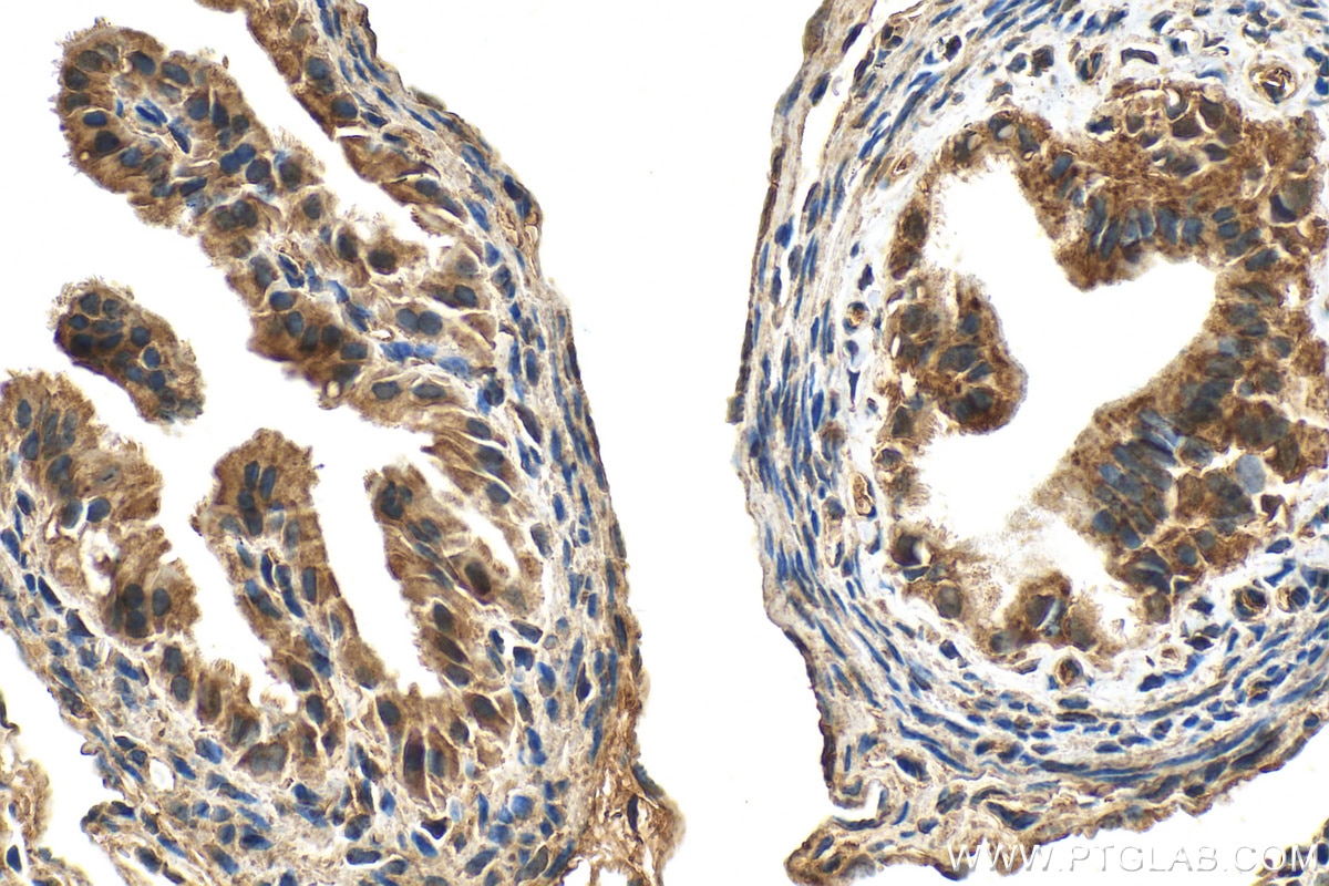Immunohistochemistry (IHC) staining of mouse ovary tissue using PGRMC1 Polyclonal antibody (12990-1-AP)