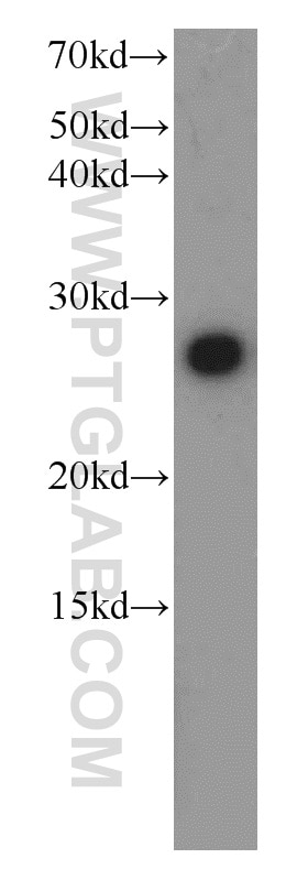 Western Blot (WB) analysis of mouse liver tissue using PGRMC1 Polyclonal antibody (12990-1-AP)