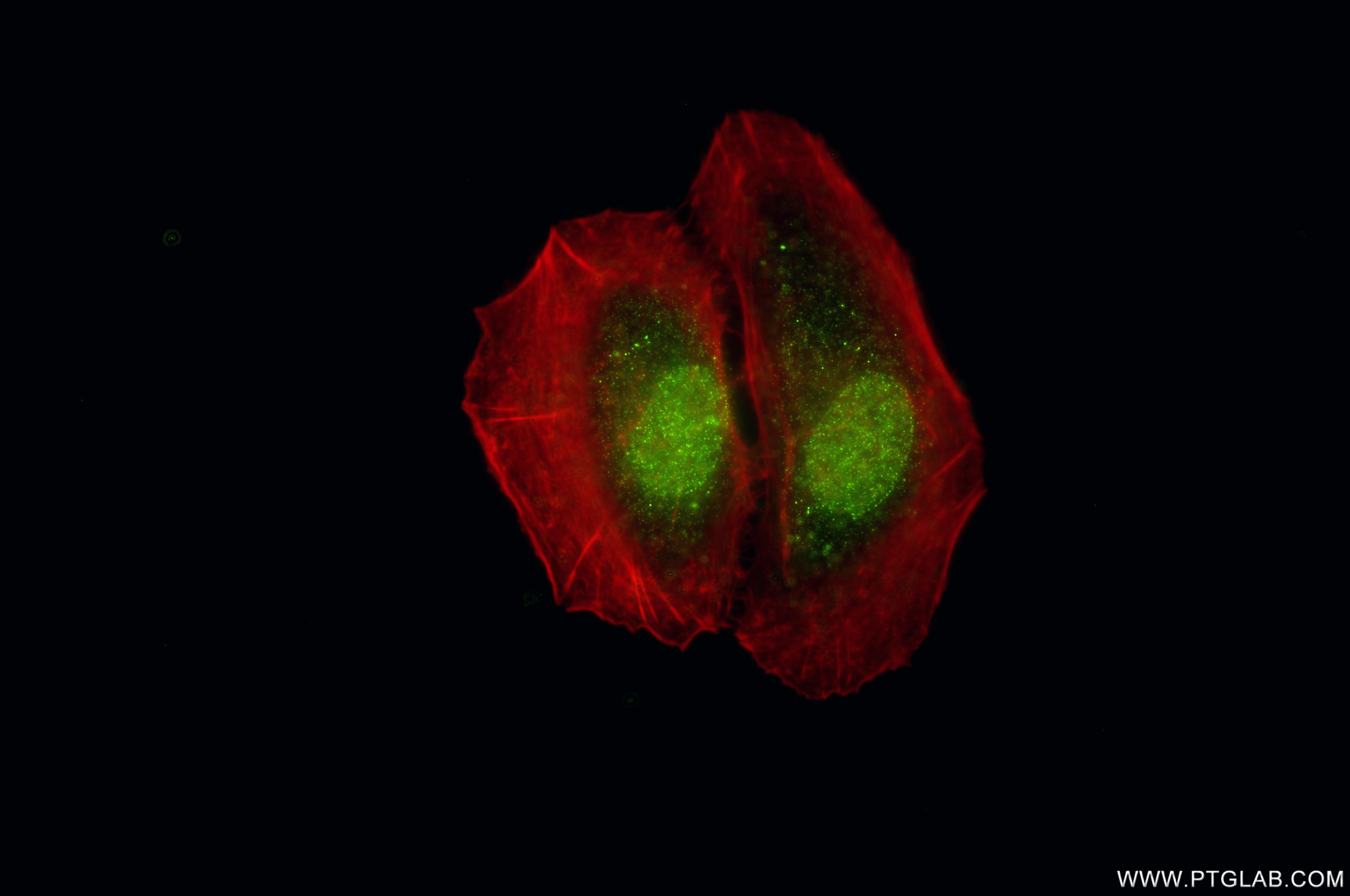 IF Staining of HeLa using 86835-1-RR (same clone as 86835-1-PBS) Immunofluorescence (IF) / fluorescent staining of HeLa cells using PGRMC2 Recombinant monoclonal antibody (86835-1-RR)