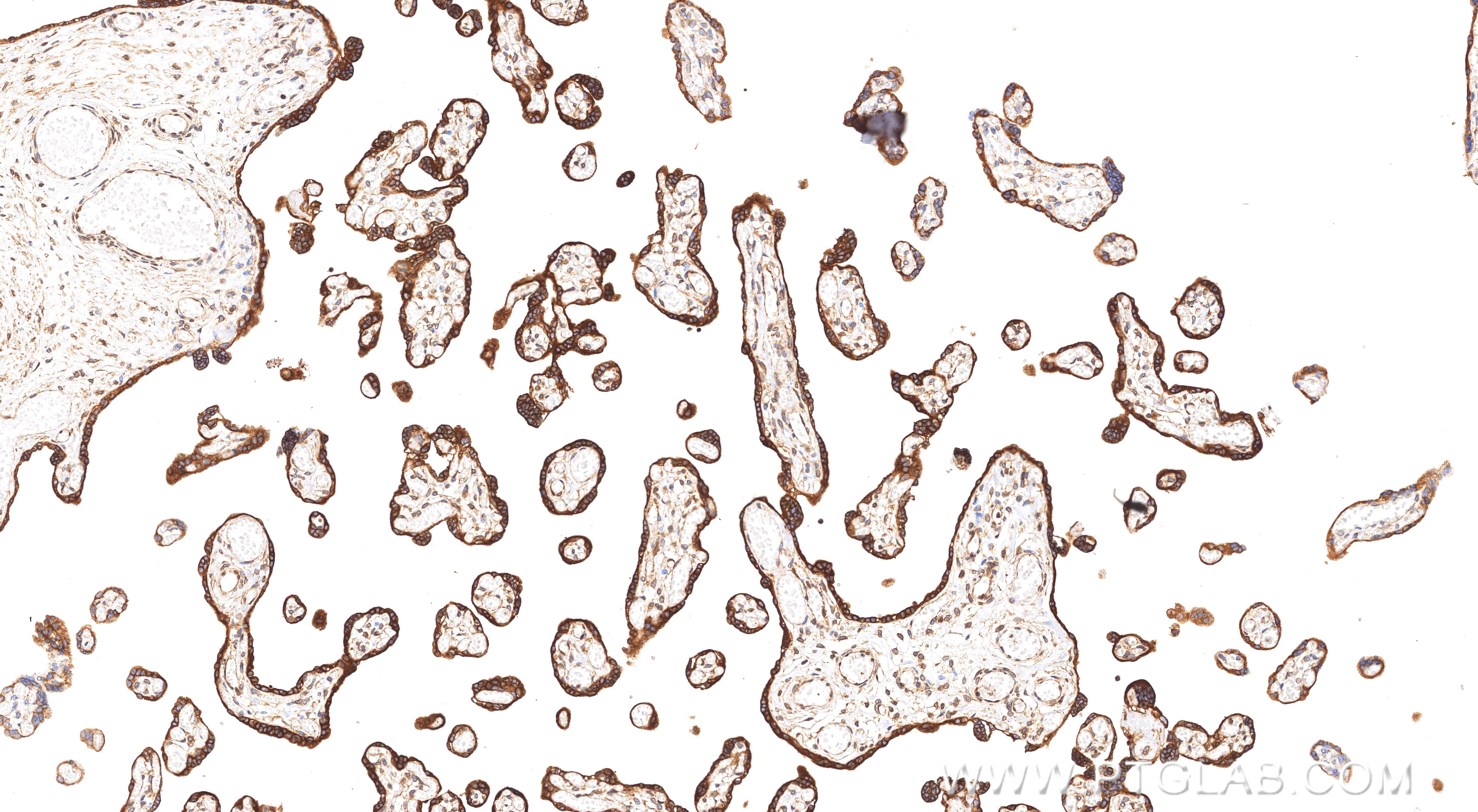 IHC staining of human placenta using 86835-1-RR (same clone as 86835-1-PBS) Immunohistochemistry (IHC) staining of human placenta tissue using PGRMC2 Recombinant monoclonal antibody (86835-1-RR)