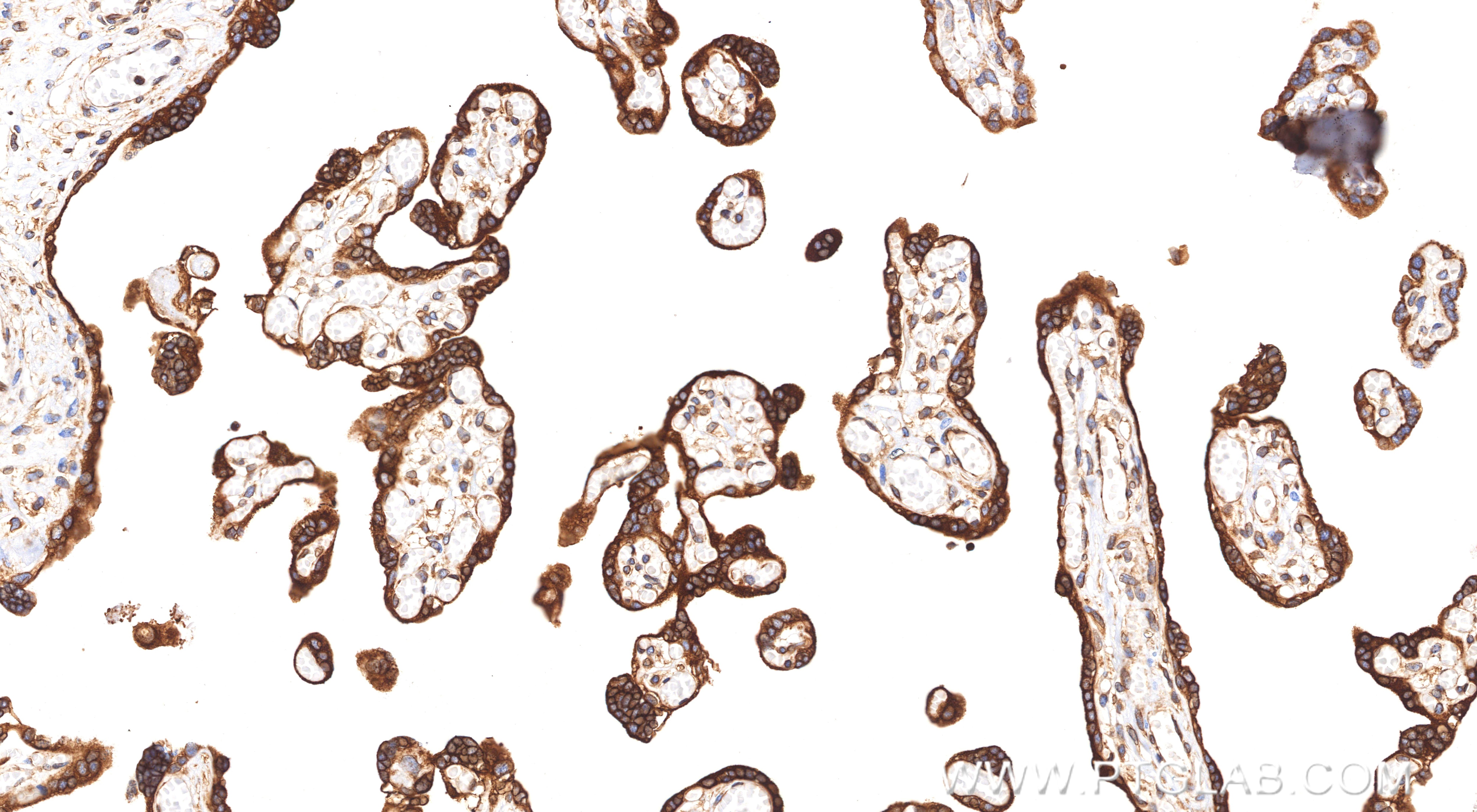 IHC staining of human placenta using 86835-1-RR (same clone as 86835-1-PBS) Immunohistochemistry (IHC) staining of human placenta tissue using PGRMC2 Recombinant monoclonal antibody (86835-1-RR)