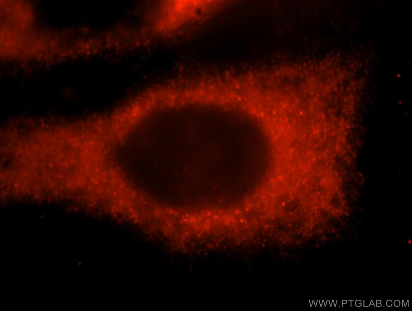 Immunofluorescence (IF) / fluorescent staining of HeLa cells using PGS1 Polyclonal antibody (17149-1-AP)
