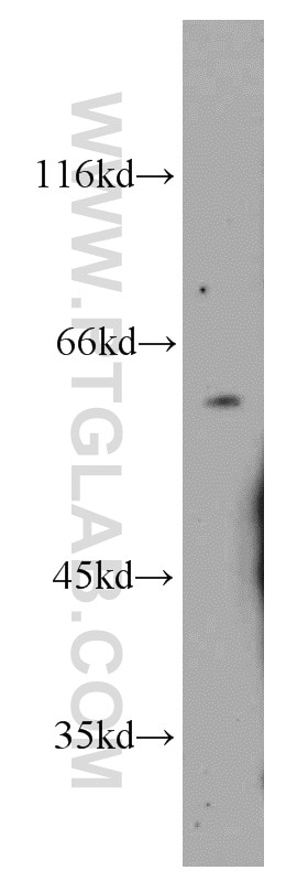 Western Blot (WB) analysis of mouse liver tissue using PGS1 Polyclonal antibody (17149-1-AP)