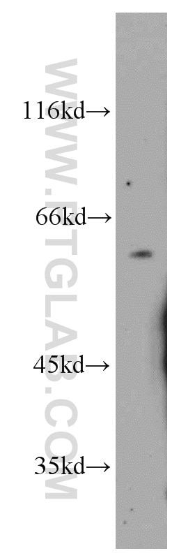 WB analysis of mouse liver using 17149-1-AP