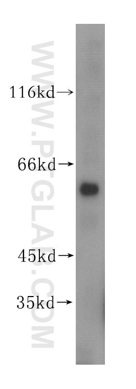 Western Blot (WB) analysis of mouse liver tissue using PGS1 Polyclonal antibody (17149-1-AP)
