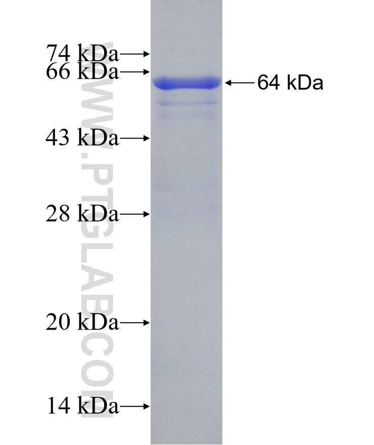 PGS1 fusion protein Ag10961 SDS-PAGE