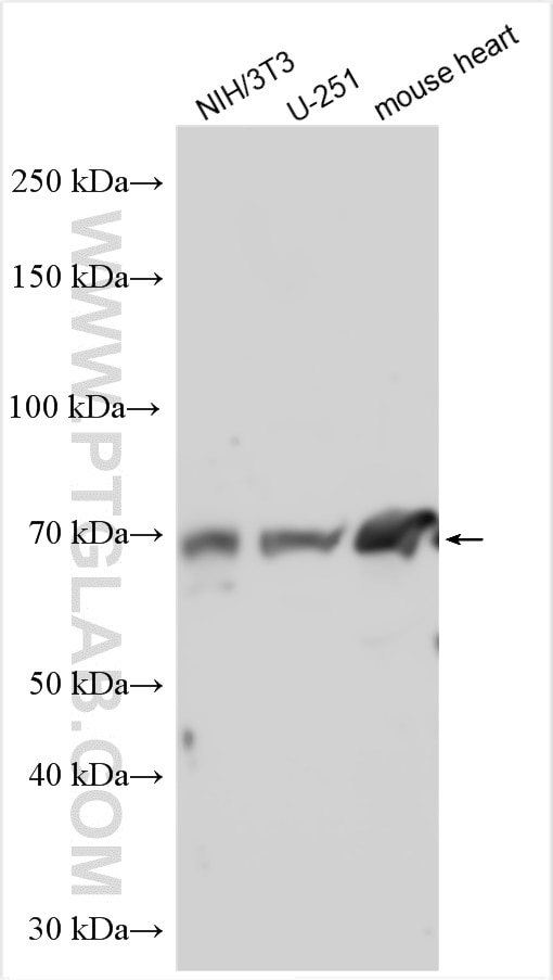 Western Blot (WB) analysis of various lysates using PGT Polyclonal antibody (30434-1-AP)